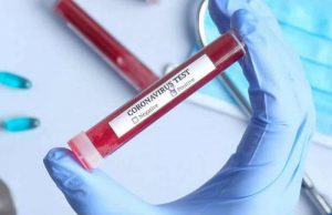Estado confirma 35.343 casos e 420 mortes por Covid-19