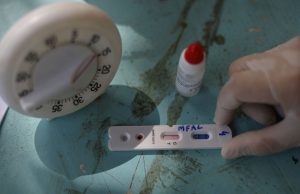 Covid-19: Brasil tem 2,96 milhões de casos e 99,5 mil mortes