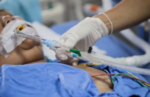 Estado tem 5 dias para adequar plano de estoques de medicamentos para intubação de pacientes com covid-19