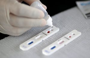 Covid-19: casos ficam estáveis e mortes apresentam leve queda