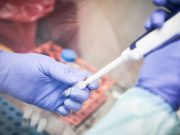 Semana de testes confirma tendência de queda de casos de covid-19 em Tubarão