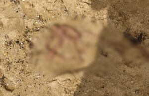 Acadêmico tem intestino arrancado numa praia deserta em Guarapari após sonho da namorada em ser cirurgiã